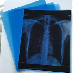 High-Quality 8″ X 10″ Inkjet Blue Medical Imaging Film – Waterproof and Precision Imaging (Pack of 100 Sheets) Inkjet Blue X-ray Films