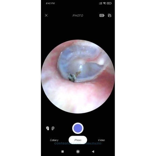 Explore In-Depth Visual Diagnostics with Our Advanced Video Otoscope – Clear Insights for Ear Health, For a fast and reliable diagnosis
